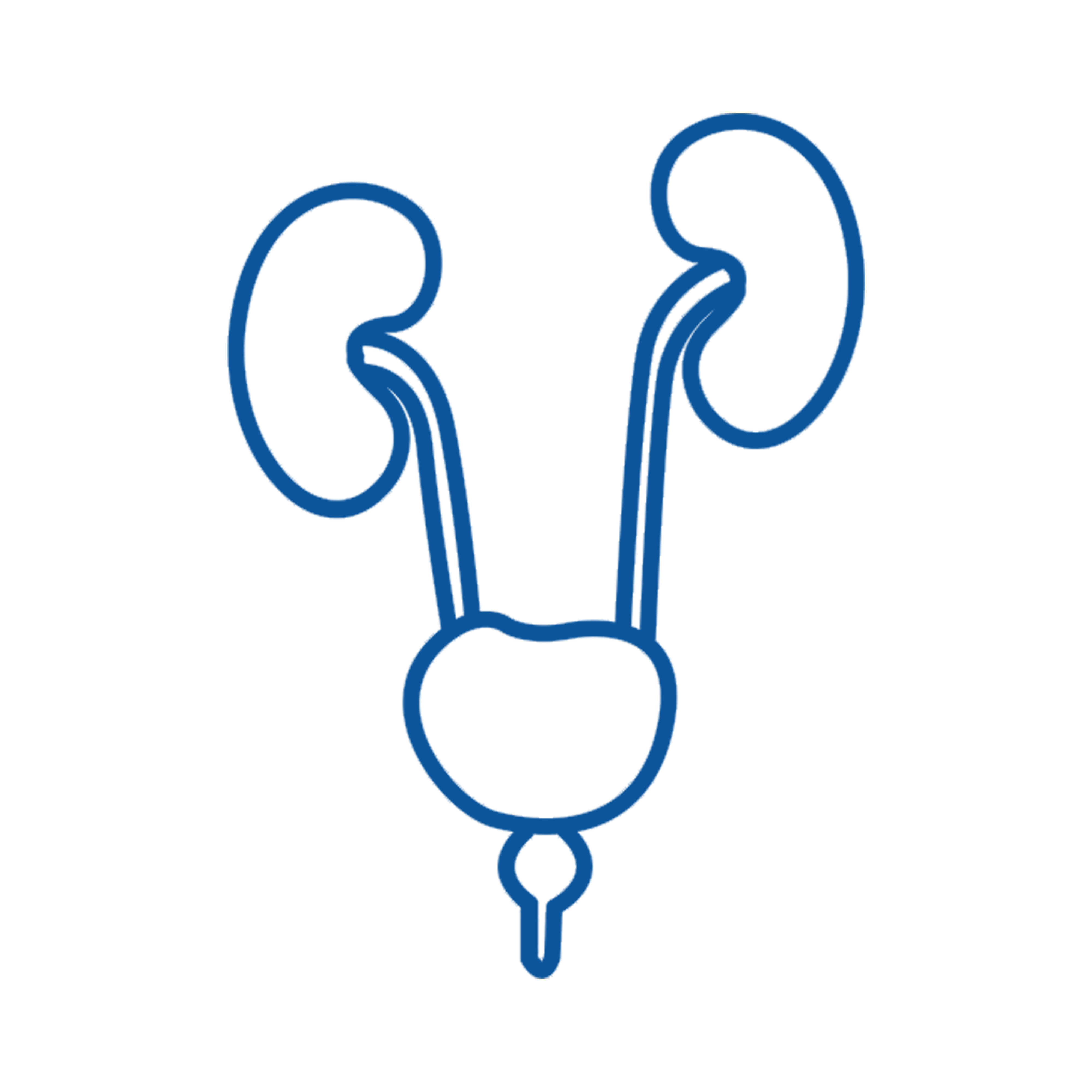 Смена пола с мужского на женский ( MtF ) В Индии